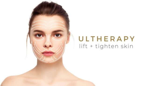 11-1024×576 ultherapy
