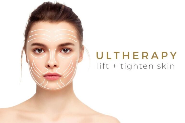 ultherapy