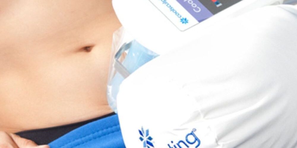 CoolSculpting coolsculpting