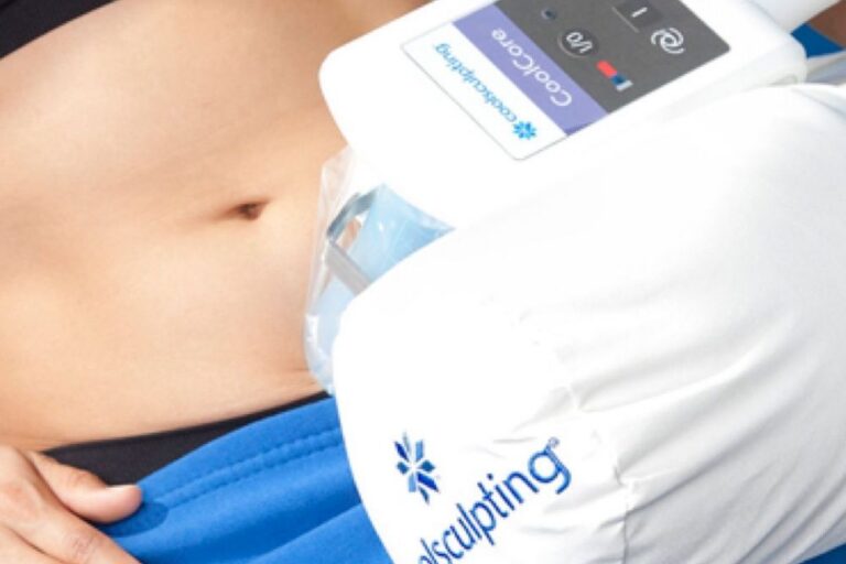 coolsculpting