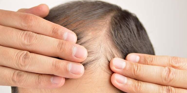 feature-hair-768×398