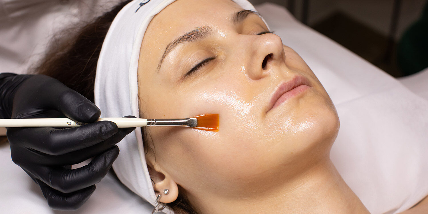Young woman is receiving chemical peel treatment