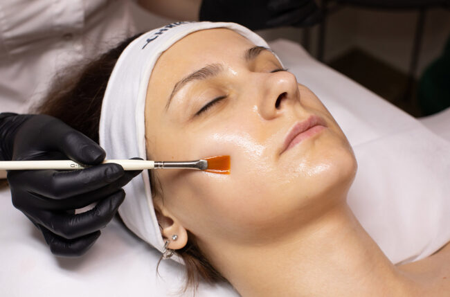 Young woman is receiving chemical peel treatment Young woman is receiving chemical peel treatment