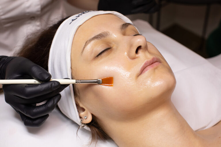 Young woman is receiving chemical peel treatment