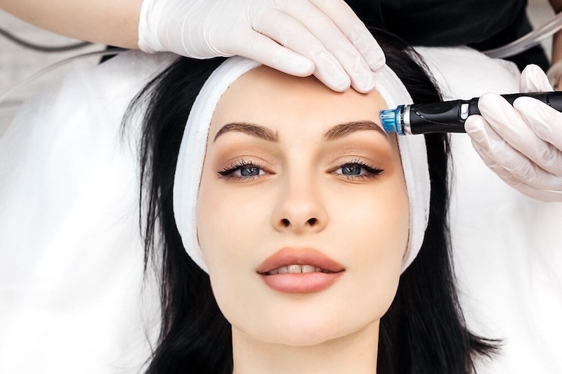 A woman receives hydrafacial treatment